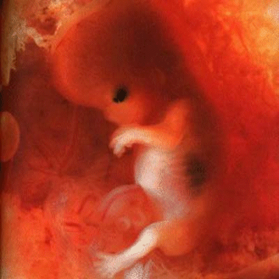 11 weeks pregnant. pictures of fetus at 11 weeks